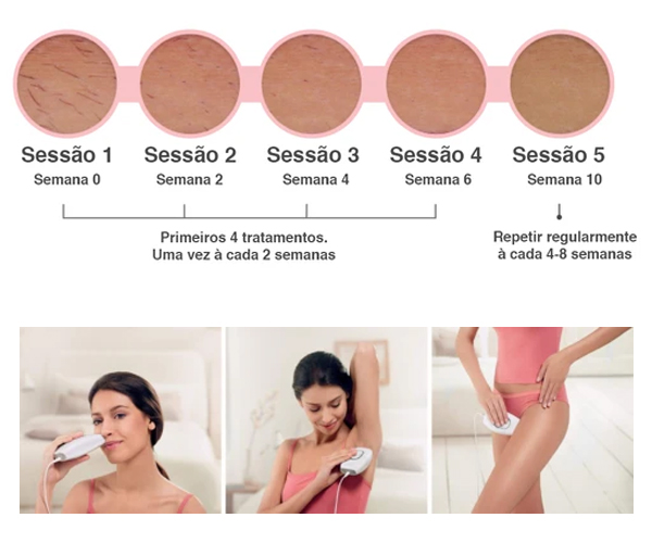 Procedimento Procedimento